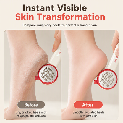 📢📢50% OFF !! ⏰ 3-in-1 Callus Remover & Foot Scrub – Safe 304 Stainless Steel, Soft Rubber Toe Bristles & Pumice Stone – Smooth Soft Feet in 3 Simple Steps 🔧