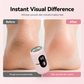 📢📢40% OFF !! ⏰Electric Foot Grinder with 6 Speeds and 5 Replacement Heads for Dead Skin Removal